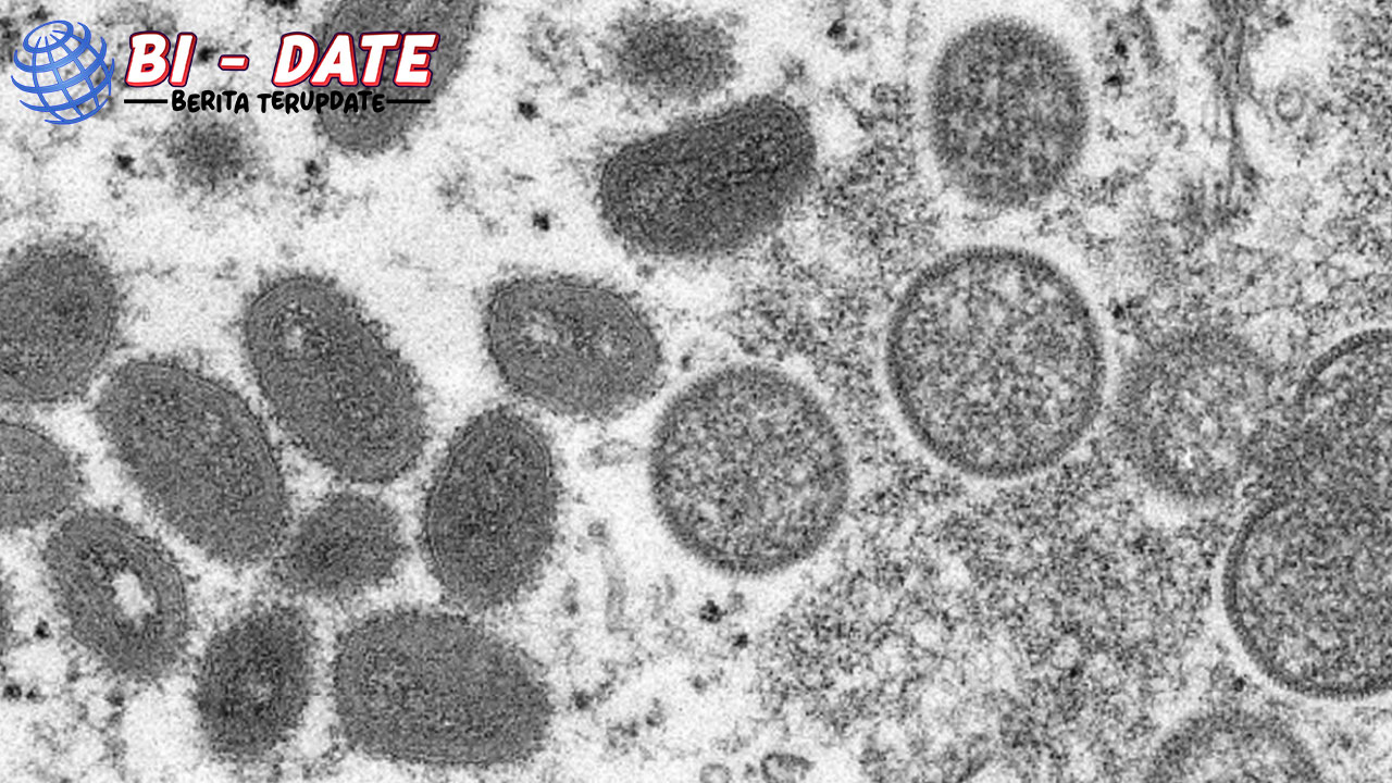 Virus Mpox Klade 1b