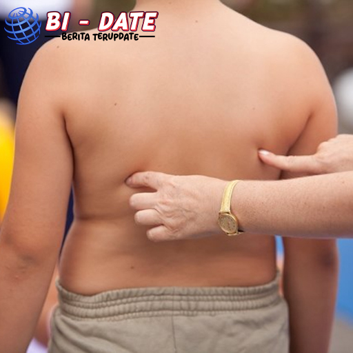 Singapura Temukan Obat Pemicu Lambung Bocor dan Sindrom!