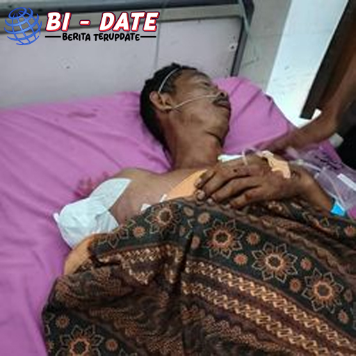 Diterkam Buaya Tangan Peternak Udang OKI Putus Seketika!
