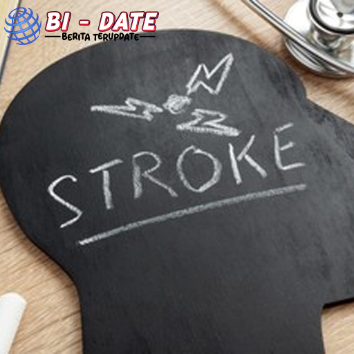 Dokter Jelaskan 4 Penyebab Kasus Stroke Usia Muda di RI!