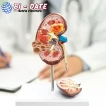 Air Hangat: Solusi Alami Bersihkan 2 Ginjal?