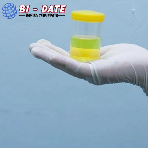 Jangan Abaikan! Urine Berubah? Bisa Jadi 1 Masalah Ginjal