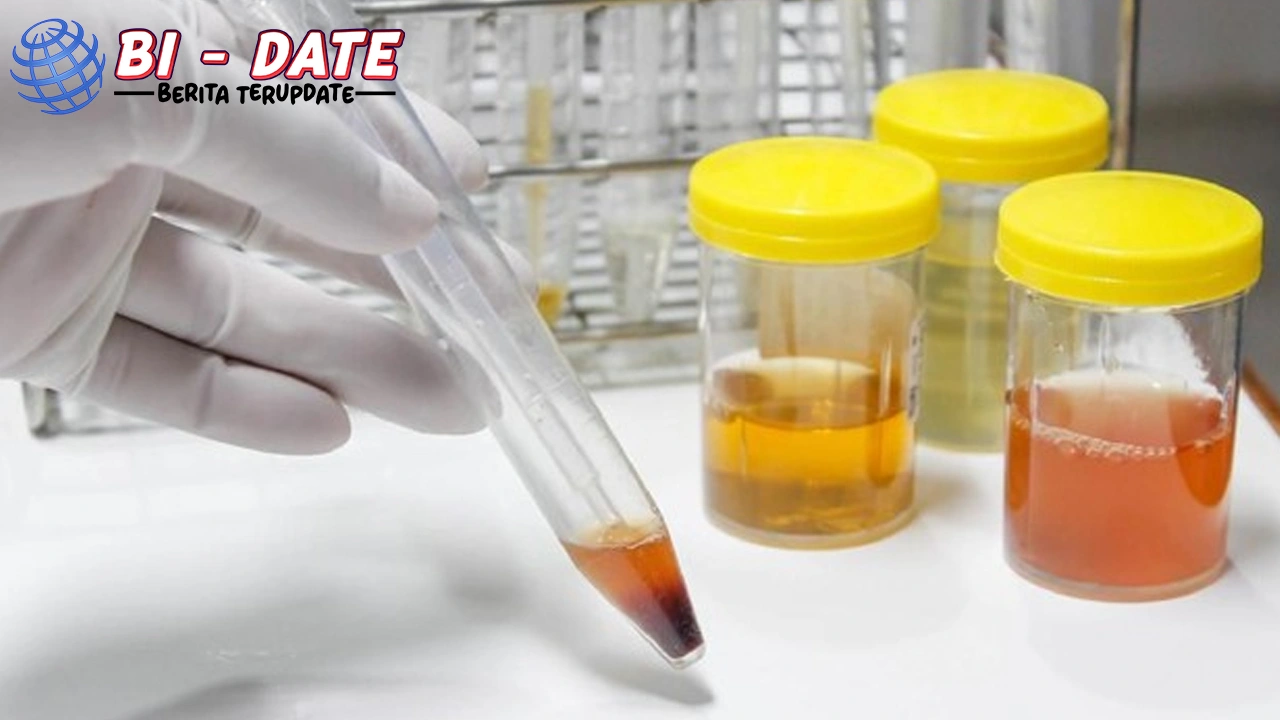 Jangan Abaikan! Urine Berubah? Bisa Jadi 1 Masalah Ginjal