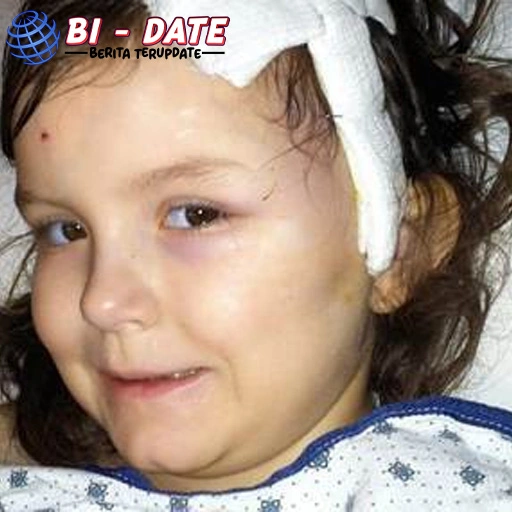 Bocah 10 Tahun Kena Stroke: Kasus Langka Merinding!