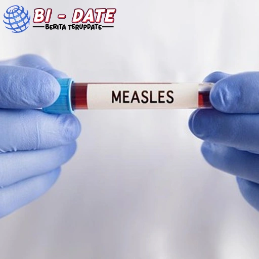 Selebgram Keluar Penuh Saat Sakit, Tersebar ke 18 Orang