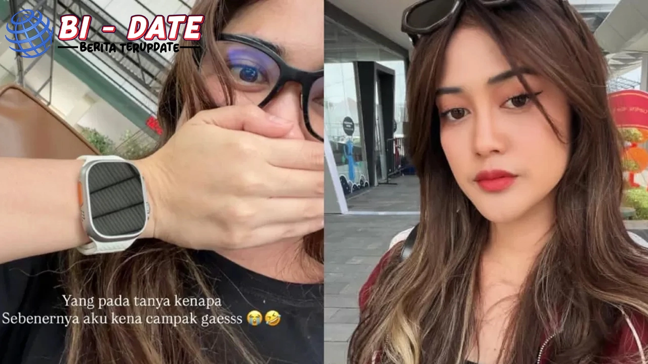 Selebgram Keluar Penuh Saat Sakit, Tersebar ke 18 Orang