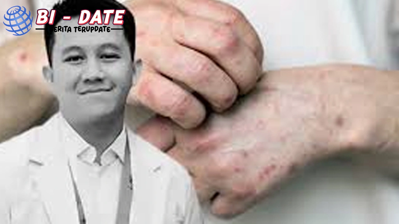 Dokter Internship 3 Wafat Kena Penuh Campak