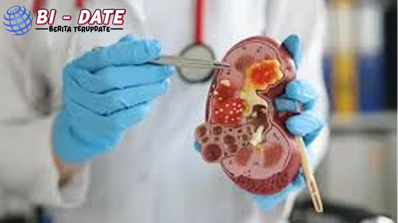 Kanker Ginjal Anak Wajib Tahu 11 Risiko Genetik