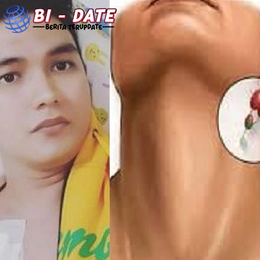 Aldi Taher Bagikan 5 Tips Makanan Sehat Pasca Kanker