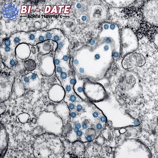 Cicada Si 2 Varian Agresif, Anak Kecil Wajib Diwaspadai